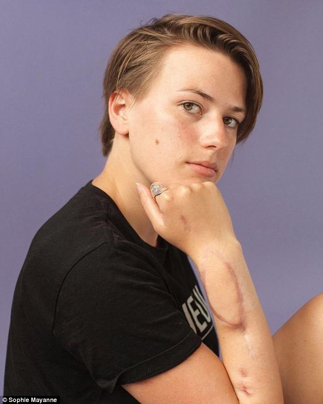 10 cô gái dũng cảm và câu chuyện vết sẹo đi theo cả cuộc đời